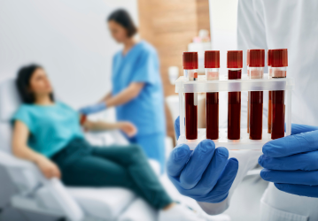 myositisindiabloodtestimage